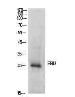 Anti-EBI3 Antibody