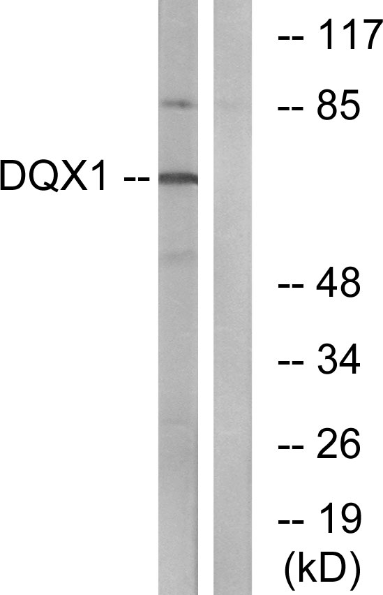 Anti-DQX1 Antibody