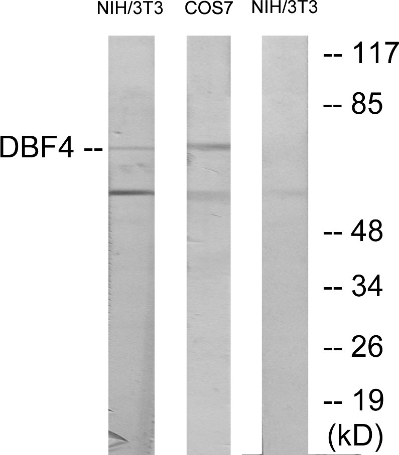 Anti-DBF4 Antibody