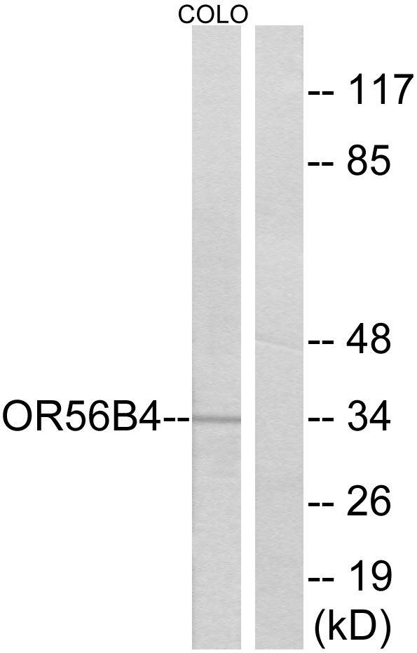 Anti-OR56B4 Antibody
