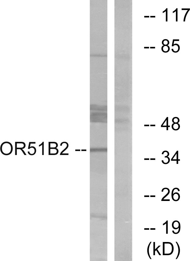 Anti-OR51B2 Antibody