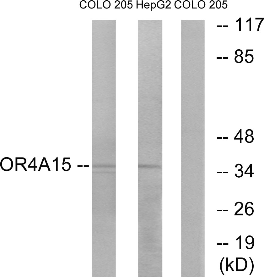Anti-OR4A15 Antibody