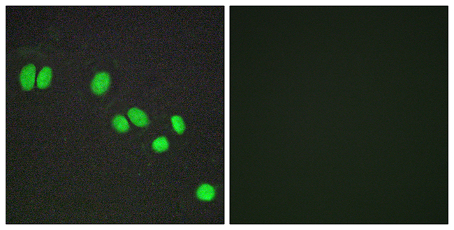 Anti-NCOR2 Antibody