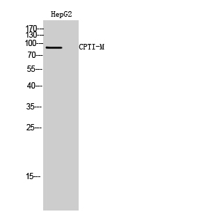 Anti-CPT1B Antibody