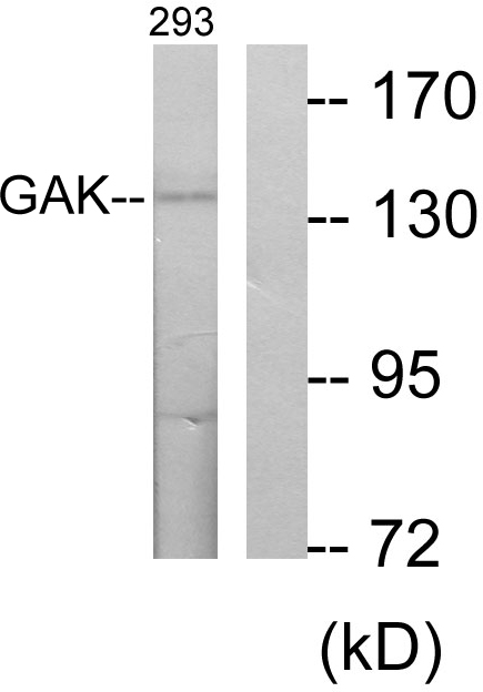 Anti-GAK Antibody