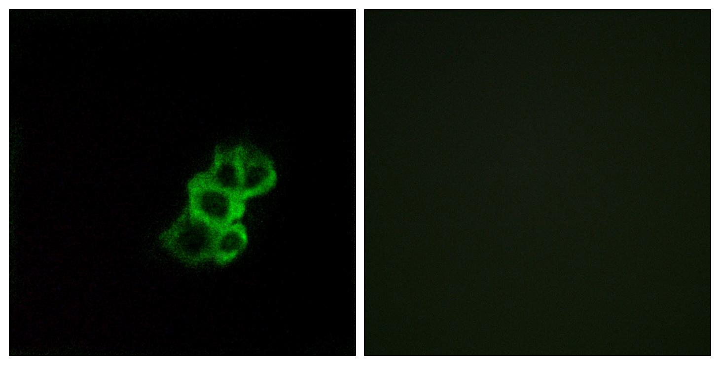 Anti-OR8B4 Antibody