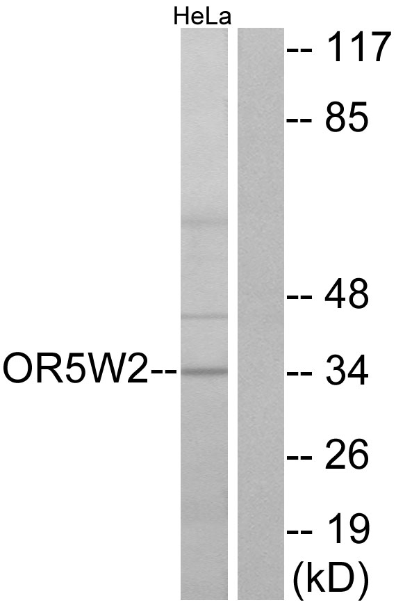 Anti-OR5W2 Antibody