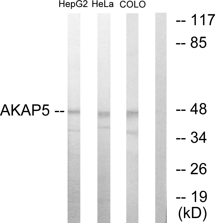 Anti-AKAP5 Antibody