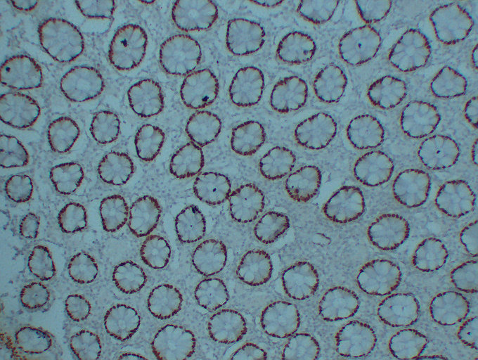 Anti-CDX 2 Antibody [ABT-CDX2]