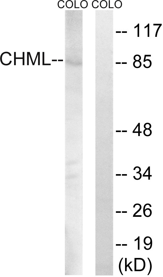 Anti-CHML Antibody