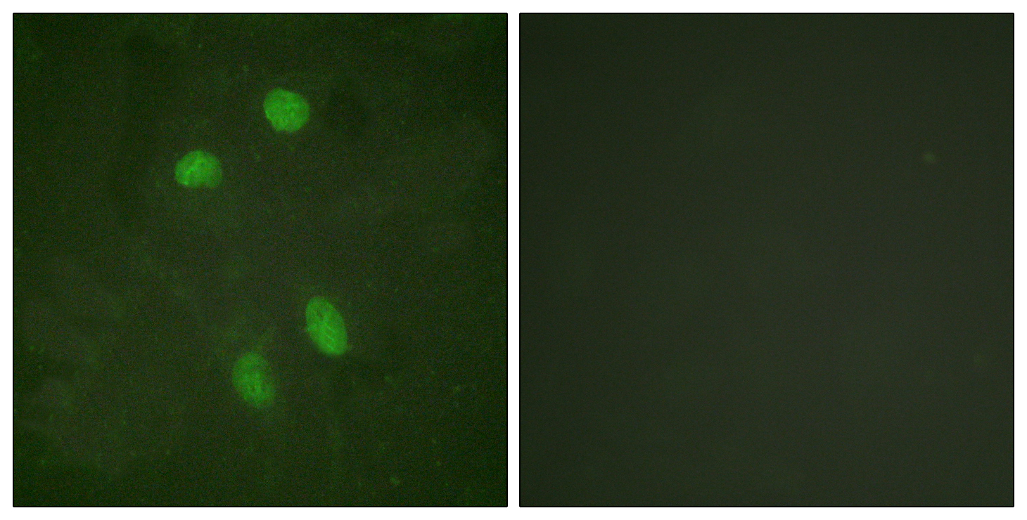 Anti-ATF2 Antibody