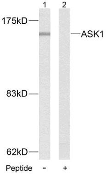 Anti-ASK1 Antibody