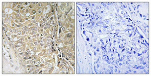 Anti-TPD52L3 Antibody